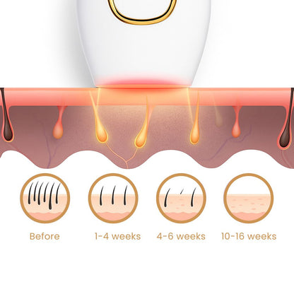 IPL Lazer Hair Remover | Intense Pulsed Light Technology