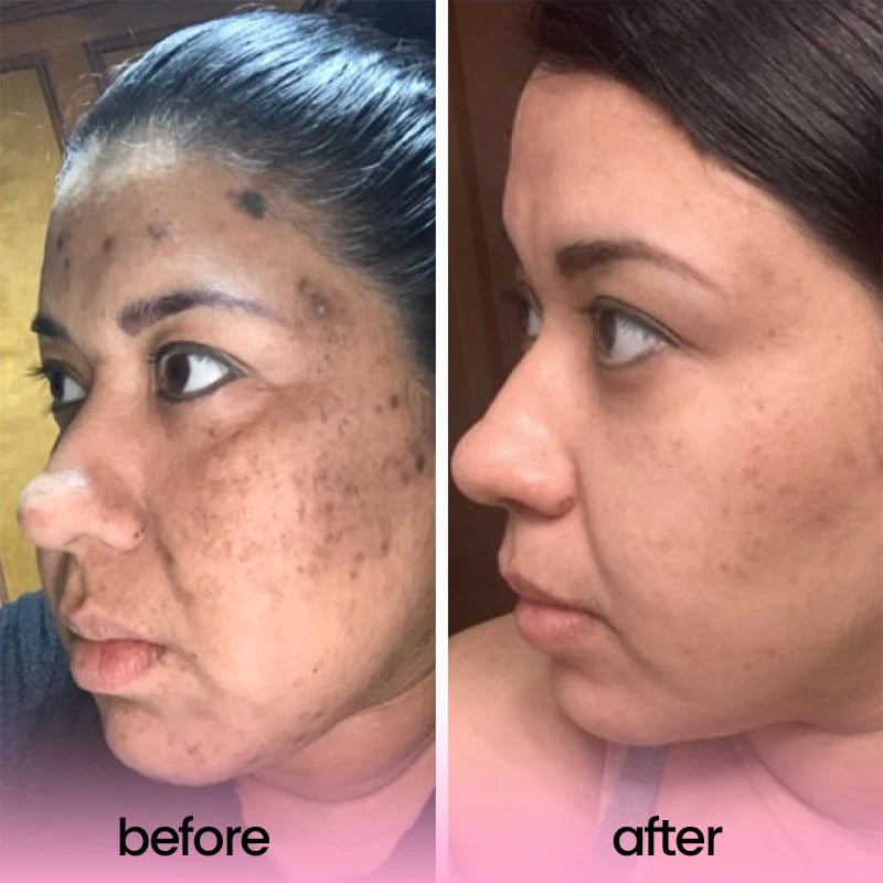 Turmeric and Kojic Acid Pads